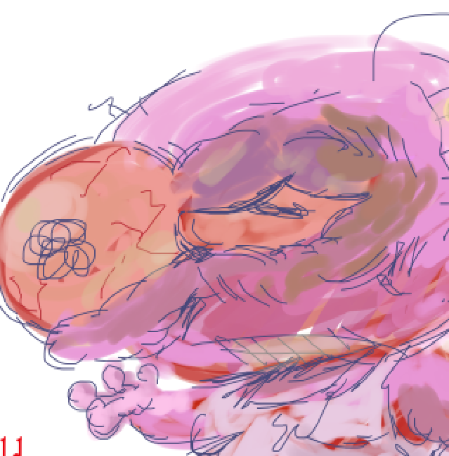 scribbly ms paint drawing of pim holding his hand up to a swelling, deformed, bruised eye